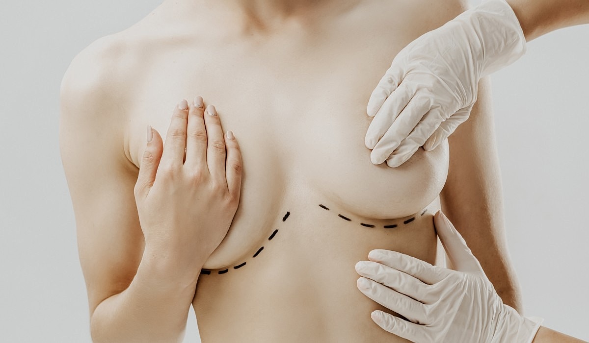 A Guide to Breast Surgery Incision Types
