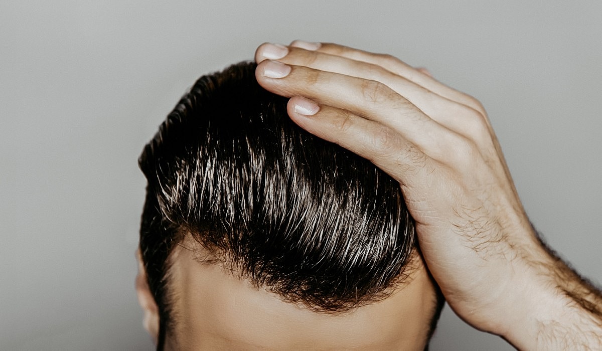 Follicular Unit Extraction (FUE): A Lasting Solution for Hair Growth