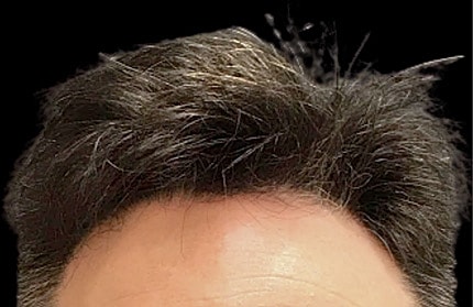 Hair Before & After