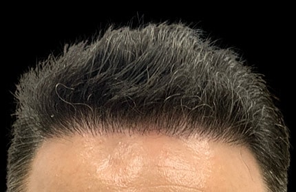 Hair Before & After