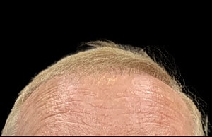 Hair Before & After
