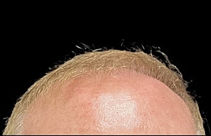 Hair Before & After