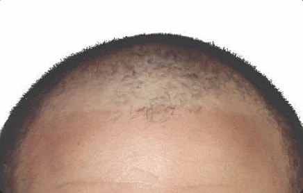 Hair Before & After