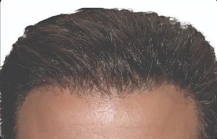 Hair Before & After