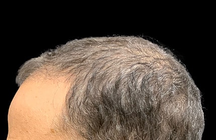 Hair Before & After