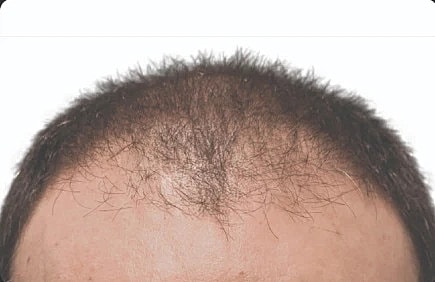 Hair Before & After