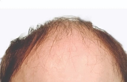 Hair Before & After