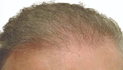 Hair Before & After