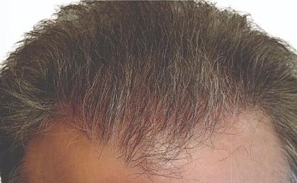 Hair Before & After
