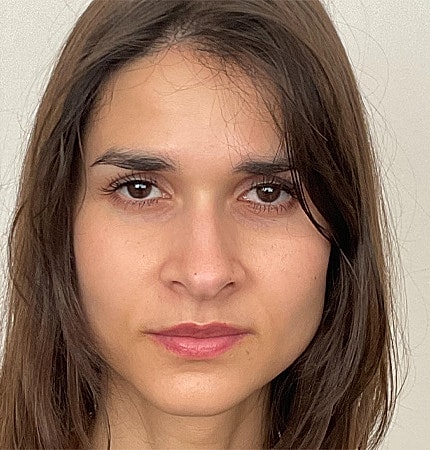 Rhinoplasty Before & After